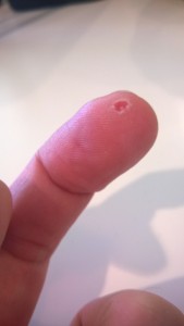 A very small cut on my finger